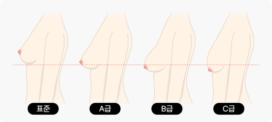 胸吊り上げ自己診断