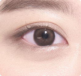 Upper Eyelid