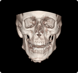 3D-CT精密检查
