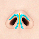If the cartilage of the nostrils is spread left and right