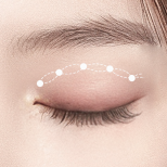 Signature Double Eyelid Surgery