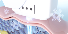 痛みの心配NO!