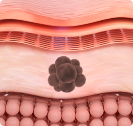 Still have pigmentation left even after repeated treatments?