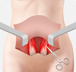 Tissue Excision and Skin Removal