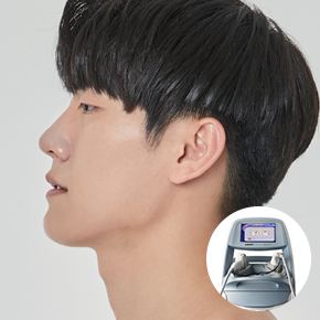 남자 레이저 제모