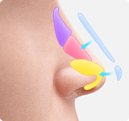 オーダーメイドデザインの人工物