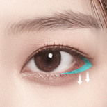 시그니처 트임성형