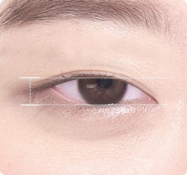 高度下垂