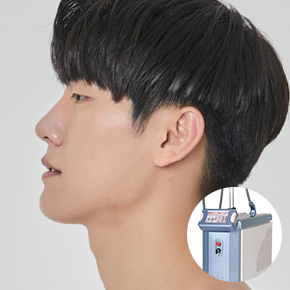 男性レーザー脱毛