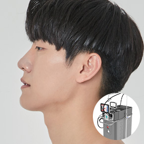 남자 레이저 제모