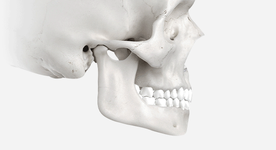 Square Jaw Reduction Surgery