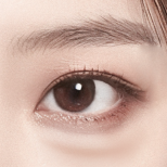 Signature Lower Blepharoplasty