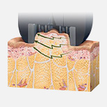 Signature Fat Dissolving Solution