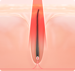 Heat Energy Transfer