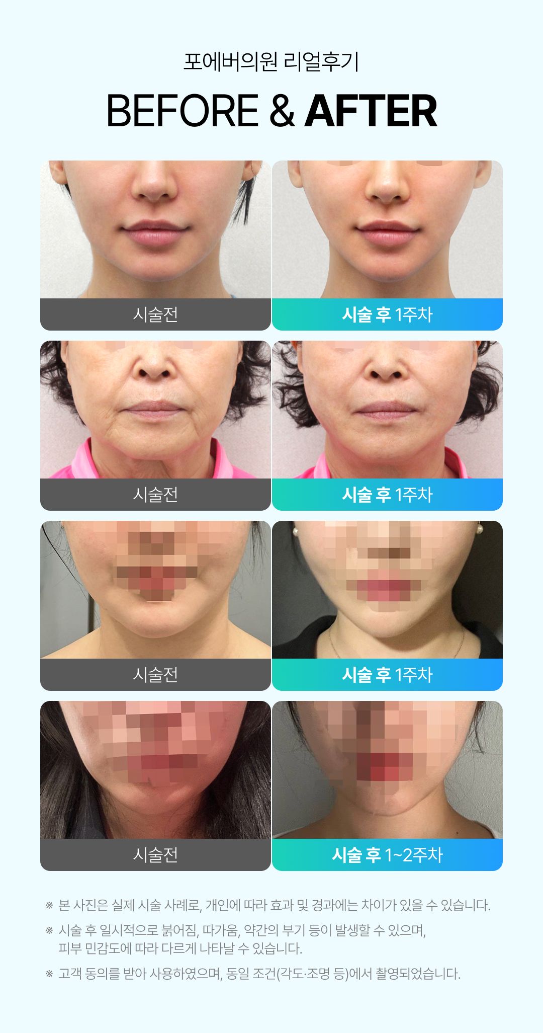 텐써마