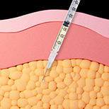 Signature Fat Dissolving Solution