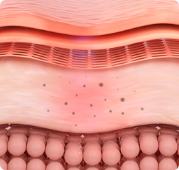 フォーエバークリニックの色素ターゲットレーザーとは？