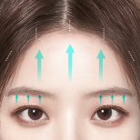 FOREVER Forehead & Sub-brow Lift