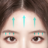 FULL HD Endoscopic Forehead Lift