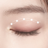 自然癒着埋没法